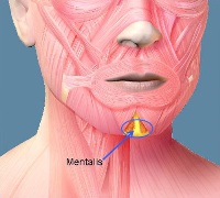 cleft chin removal before and after